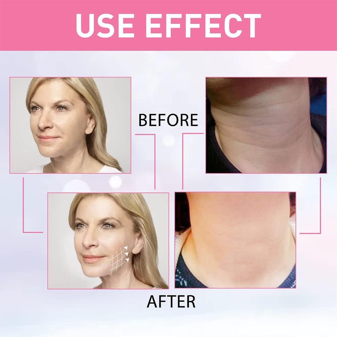 Massajador EMS Profissional Térmico Facial (OFERTA CREME ROSTO DE HIBISCO E MEL)