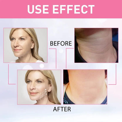 Massajador EMS Profissional Térmico Facial (OFERTA CREME ROSTO DE HIBISCO E MEL)