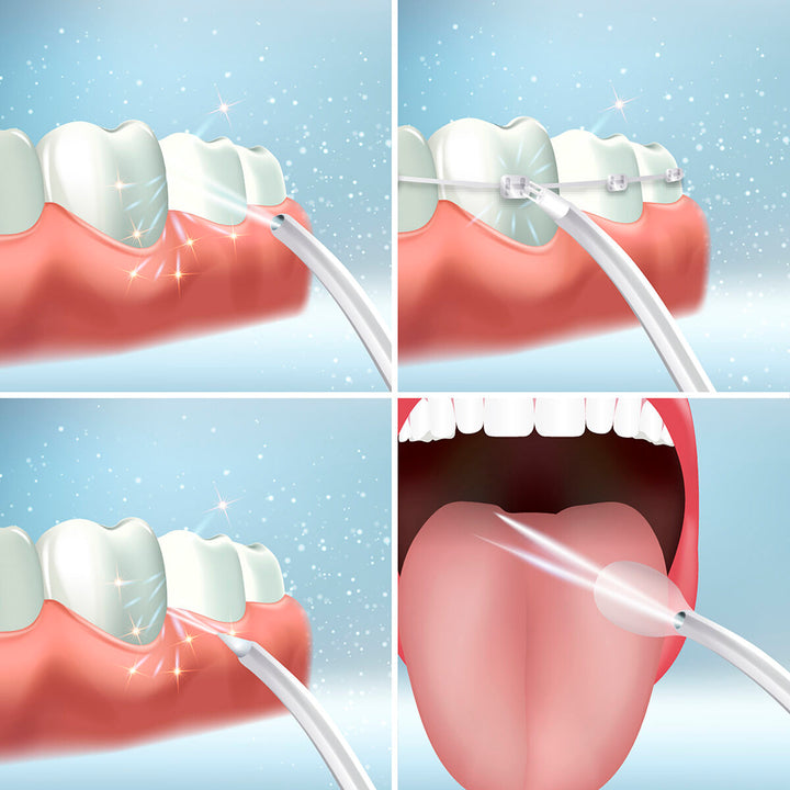 Irrigador Oral Portátil PPS